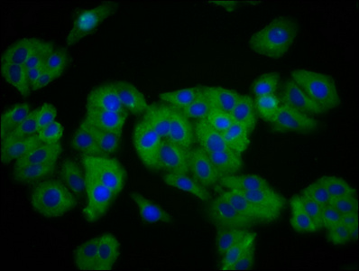 SLC41A1 Antibody - Immunofluorescence staining of HepG2 cells diluted at 1:133, counter-stained with DAPI. The cells were fixed in 4% formaldehyde, permeabilized using 0.2% Triton X-100 and blocked in 10% normal Goat Serum. The cells were then incubated with the antibody overnight at 4°C.The Secondary antibody was Alexa Fluor 488-congugated AffiniPure Goat Anti-Rabbit IgG (H+L).