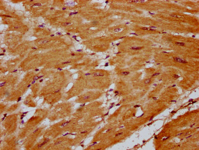 SLC41A1 Antibody - Immunohistochemistry Dilution at 1:400 and staining in paraffin-embedded human heart tissue performed on a Leica BondTM system. After dewaxing and hydration, antigen retrieval was mediated by high pressure in a citrate buffer (pH 6.0). Section was blocked with 10% normal Goat serum 30min at RT. Then primary antibody (1% BSA) was incubated at 4°C overnight. The primary is detected by a biotinylated Secondary antibody and visualized using an HRP conjugated SP system.