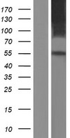 SLC41A1 Protein - Western validation with an anti-DDK antibody * L: Control HEK293 lysate R: Over-expression lysate