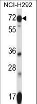SLC41A2 Antibody - SLC41A2 Antibody western blot of NCI-H292 cell line lysates (35 ug/lane). The SLC41A2 antibody detected the SLC41A2 protein (arrow).
