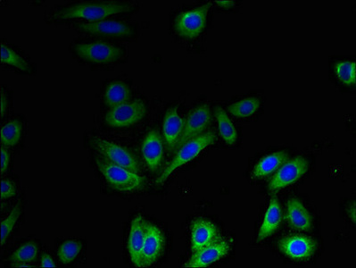 SLC41A2 Antibody - Immunofluorescent analysis of HepG2 cells using SLC41A2 Antibody at dilution of 1:100 and Alexa Fluor 488-congugated AffiniPure Goat Anti-Rabbit IgG(H+L)