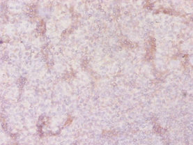 SLC41A2 Antibody - Immunohistochemistry of paraffin-embedded human tonsil tissue using SLC41A2 Antibody at dilution of 1:20