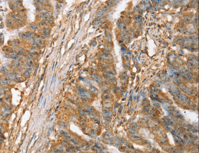 SLC41A2 Antibody - Immunohistochemistry of paraffin-embedded Human brain using SLC41A3 Polyclonal Antibody at dilution of 1:45.