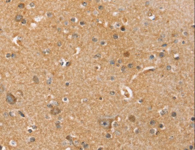 SLC41A2 Antibody - Immunohistochemistry of paraffin-embedded Human brain using SLC41A3 Polyclonal Antibody at dilution of 1:45.