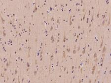 SLC41A3 Antibody - Immunochemical staining of human SLC41A3 in human brain with rabbit polyclonal antibody at 1:100 dilution, formalin-fixed paraffin embedded sections.