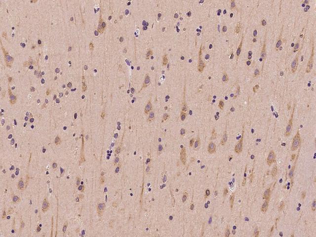 SLC41A3 Antibody - Immunochemical staining of human SLC41A3 in human brain with rabbit polyclonal antibody at 1:100 dilution, formalin-fixed paraffin embedded sections.