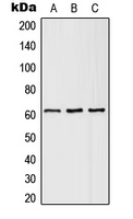 SLC43A1 Antibody - Western blot analysis of SLC43A1 expression in HEK293T (A); SP2/0 (B); H9C2 (C) whole cell lysates.