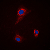 SLC43A1 Antibody - Immunofluorescent analysis of SLC43A1 staining in H9C2 cells. Formalin-fixed cells were permeabilized with 0.1% Triton X-100 in TBS for 5-10 minutes and blocked with 3% BSA-PBS for 30 minutes at room temperature. Cells were probed with the primary antibody in 3% BSA-PBS and incubated overnight at 4 C in a humidified chamber. Cells were washed with PBST and incubated with a DyLight 594-conjugated secondary antibody (red) in PBS at room temperature in the dark. DAPI was used to stain the cell nuclei (blue).