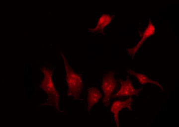 SLC43A1 Antibody - Staining A549 cells by IF/ICC. The samples were fixed with PFA and permeabilized in 0.1% Triton X-100, then blocked in 10% serum for 45 min at 25°C. The primary antibody was diluted at 1:200 and incubated with the sample for 1 hour at 37°C. An Alexa Fluor 594 conjugated goat anti-rabbit IgG (H+L) Ab, diluted at 1/600, was used as the secondary antibody.