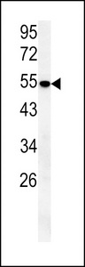 SLC43A2 Antibody - SLC43A2 Antibody western blot of mouse lung tissue lysates (15 ug/lane). The SLC43A2 antibody detected SLC43A2 protein (arrow).