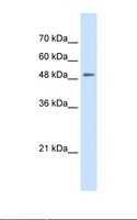 SLC43A2 Antibody - Jurkat cell lysate. Antibody concentration: 0.25 ug/ml. Gel concentration: 12%.  This image was taken for the unconjugated form of this product. Other forms have not been tested.