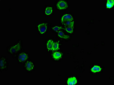 SLC43A3 Antibody - Immunofluorescent analysis of MCF-7 cells using SLC43A3 Antibody at dilution of 1:100 and Alexa Fluor 488-congugated AffiniPure Goat Anti-Rabbit IgG(H+L)