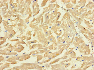 SLC43A3 Antibody - Immunohistochemistry of paraffin-embedded human heart tissue using SLC43A3 Antibody at dilution of 1:100