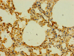 SLC43A3 Antibody - Immunohistochemistry of paraffin-embedded human lung tissue using SLC43A3 Antibody at dilution of 1:100