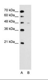 SLC43A3 Antibody - A: Marker, B: Jurkat Cell Lysate.  This image was taken for the unconjugated form of this product. Other forms have not been tested.