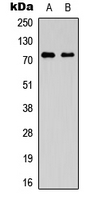 SLC44A1 / CD92 Antibody - Western blot analysis of CD92 expression in A549 (A); Jurkat (B) whole cell lysates.