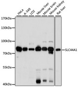 SLC44A1 / CD92 Antibody - Western blot analysis of extracts of various cell lines, using SLC44A1 antibody at 1:1000 dilution. The secondary antibody used was an HRP Goat Anti-Rabbit IgG (H+L) at 1:10000 dilution. Lysates were loaded 25ug per lane and 3% nonfat dry milk in TBST was used for blocking. An ECL Kit was used for detection and the exposure time was 30s.