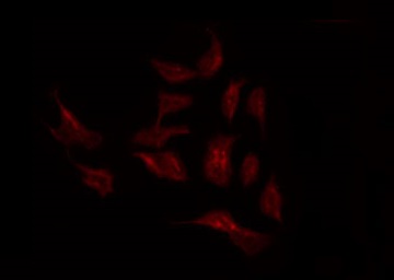 SLC44A1 / CD92 Antibody - Staining K562 cells by IF/ICC. The samples were fixed with PFA and permeabilized in 0.1% Triton X-100, then blocked in 10% serum for 45 min at 25°C. The primary antibody was diluted at 1:200 and incubated with the sample for 1 hour at 37°C. An Alexa Fluor 594 conjugated goat anti-rabbit IgG (H+L) Ab, diluted at 1/600, was used as the secondary antibody.