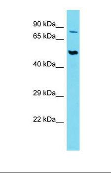 SLC44A2 / CTL2 Antibody - Western blot of Human Thymus Tumor. SLC44A2 antibody dilution 1.0 ug/ml.  This image was taken for the unconjugated form of this product. Other forms have not been tested.