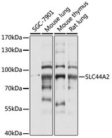 SLC44A2 / CTL2 Antibody - Western blot analysis of extracts of various cell lines, using SLC44A2 antibody at 1:1000 dilution. The secondary antibody used was an HRP Goat Anti-Rabbit IgG (H+L) at 1:10000 dilution. Lysates were loaded 25ug per lane and 3% nonfat dry milk in TBST was used for blocking. An ECL Kit was used for detection and the exposure time was 5s.