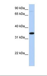 SLC44A3 Antibody - Hela cell lysate. Antibody concentration: 1.0 ug/ml. Gel concentration: 12%.  This image was taken for the unconjugated form of this product. Other forms have not been tested.