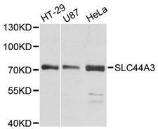 SLC44A3 Antibody - Western blot analysis of extracts of various cell lines, using SLC44A3 antibody at 1:3000 dilution. The secondary antibody used was an HRP Goat Anti-Rabbit IgG (H+L) at 1:10000 dilution. Lysates were loaded 25ug per lane and 3% nonfat dry milk in TBST was used for blocking. An ECL Kit was used for detection and the exposure time was 30s.