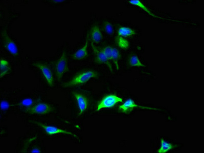 SLC44A4 Antibody - Immunofluorescent analysis of Hela cells using SLC44A4 Antibody at dilution of 1:100 and Alexa Fluor 488-congugated AffiniPure Goat Anti-Rabbit IgG(H+L)