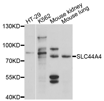 SLC44A4 Antibody - Western blot analysis of extracts of various cell lines, using SLC44A4 antibody at 1:1000 dilution. The secondary antibody used was an HRP Goat Anti-Rabbit IgG (H+L) at 1:10000 dilution. Lysates were loaded 25ug per lane and 3% nonfat dry milk in TBST was used for blocking. An ECL Kit was used for detection and the exposure time was 5s.