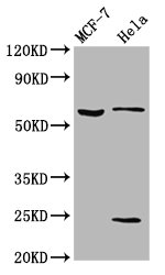 SLC45A2 Antibody - Western Blot Positive WB detected in: MCF-7 whole cell lysate, Hela whole cell lysate All Lanes: SLC45A2 antibody at 5.3µg/ml Secondary Goat polyclonal to rabbit IgG at 1/50000 dilution Predicted band size: 59, 34, 52 KDa Observed band size: 59 KDa