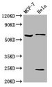 SLC45A2 Antibody - Western Blot Positive WB detected in: MCF-7 whole cell lysate, Hela whole cell lysate All Lanes: SLC45A2 antibody at 5.3µg/ml Secondary Goat polyclonal to rabbit IgG at 1/50000 dilution Predicted band size: 59, 34, 52 KDa Observed band size: 59 KDa