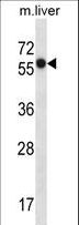 SLC45A3 / Prostein / p501S Antibody - SLC45A3 Antibody western blot of mouse liver tissue lysates (35 ug/lane). The SLC45A3 antibody detected the SLC45A3 protein (arrow).