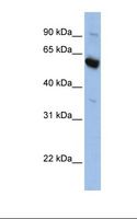 SLC45A3 / Prostein / p501S Antibody - HepG2 cell lysate. Antibody concentration: 1.0 ug/ml. Gel concentration: 12%.  This image was taken for the unconjugated form of this product. Other forms have not been tested.