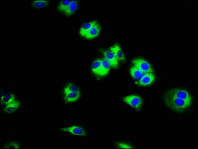 SLC45A3 / Prostein / p501S Antibody - Immunofluorescence staining of HepG2 cells with SLC45A3 Antibody at 1:100, counter-stained with DAPI. The cells were fixed in 4% formaldehyde, permeabilized using 0.2% Triton X-100 and blocked in 10% normal Goat Serum. The cells were then incubated with the antibody overnight at 4°C. The secondary antibody was Alexa Fluor 488-congugated AffiniPure Goat Anti-Rabbit IgG(H+L).