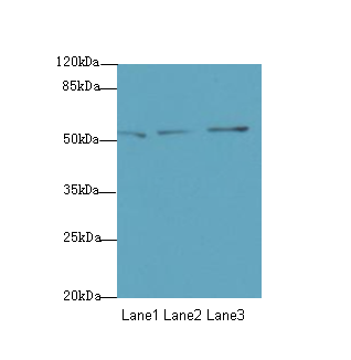SLC46A2 Antibody - Western blot. All lanes: SLC46A2 antibody at 8 ug/ml. Lane 1: HT29 whole cell lysate. Lane 2: Mouse liver tissue. Lane 3: Mouse kidney tissue. Secondary Goat polyclonal to Rabbit IgG at 1:10000 dilution. Predicted band size: 51 kDa. Observed band size: 51 kDa.