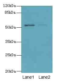 SLC46A3 Antibody - Western blot. All lanes: SLC46A3 antibody at 4 ug/ml. Lane 1: Jurkat whole cell lysate. Lane 2: U251 whole cell lysate. Secondary Goat polyclonal to Rabbit IgG at 1:10000 dilution. Predicted band size: 52 kDa. Observed band size: 52 kDa.