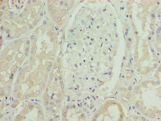SLC46A3 Antibody - Immunohistochemistry of paraffin-embedded human kidney tissue using SLC46A3 Antibody at dilution of 1:100