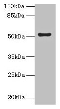 SLC46A3 Antibody - Western blot All lanes: SLC46A3 antibody at 4µg/ml Lane 1: Jurkat whole cell lysate Lane 2: U251 whole cell lysate Secondary Goat polyclonal to rabbit IgG at 1/10000 dilution Predicted band size: 52, 43 kDa Observed band size: 52 kDa