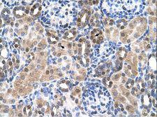SLC46A3 Antibody - SLC46A3 antibody ARP44158_T100-NP_861450-SLC46A3(solute carrier family 46, member 3) Antibody was used in IHC to stain formalin-fixed, paraffin-embedded human kidney.  This image was taken for the unconjugated form of this product. Other forms have not been tested.