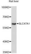 SLC47A1 / MATE1 Antibody - Western blot analysis of extracts of rat liver, using SLC47A1 antibody at 1:1000 dilution. The secondary antibody used was an HRP Goat Anti-Rabbit IgG (H+L) at 1:10000 dilution. Lysates were loaded 25ug per lane and 3% nonfat dry milk in TBST was used for blocking. An ECL Kit was used for detection and the exposure time was 30s.