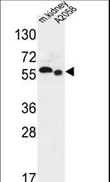 SLC47A2 Antibody - S47A2 Antibody western blot of mouse kidney tissue and A2058 cell line lysates (35 ug/lane). The S47A2 antibody detected the S47A2 protein (arrow).