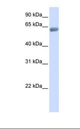 SLC47A2 Antibody - Fetal lung lysate. Antibody concentration: 1.0 ug/ml. Gel concentration: 12%.  This image was taken for the unconjugated form of this product. Other forms have not been tested.