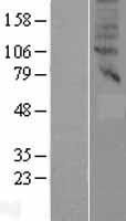 SLC47A2 Protein - Western validation with an anti-DDK antibody * L: Control HEK293 lysate R: Over-expression lysate
