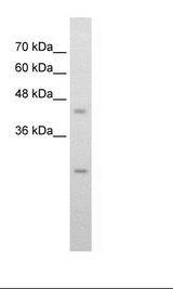 SLC48A1 / HRG1 Antibody - HepG2 Cell Lysate.  This image was taken for the unconjugated form of this product. Other forms have not been tested.