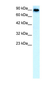 SLC4A1 / Band 3 / AE1 Antibody - SLC4A1 / Band 3 antibody Western blot of Fetal Liver lysate. This image was taken for the unconjugated form of this product. Other forms have not been tested.