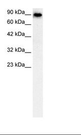 SLC4A1 / Band 3 / AE1 Antibody - Fetal Liver Lysate.  This image was taken for the unconjugated form of this product. Other forms have not been tested.