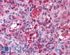 SLC4A1 / Band 3 / AE1 Antibody - Anti-Band 3 antibody IHC of human spleen. Immunohistochemistry of formalin-fixed, paraffin-embedded tissue after heat-induced antigen retrieval. Antibody concentration 5 ug/ml.  This image was taken for the unconjugated form of this product. Other forms have not been tested.
