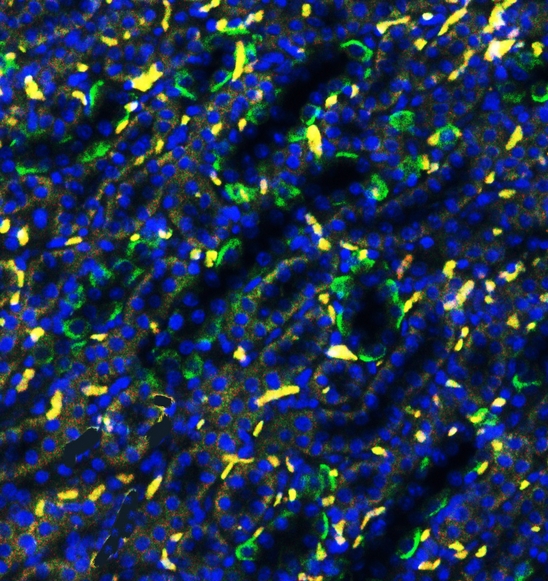 SLC4A1 / Band 3 / AE1 Antibody - IF analysis of Band 3 using anti-Band 3 antibody Band 3 was detected in paraffin-embedded section of rat kidney tissues. Heat mediated antigen retrieval was performed in citrate buffer (pH6, epitope retrieval solution ) for 20 mins. The tissue section was blocked with 10% goat serum. The tissue section was then incubated with 1µg/mL rabbit anti-Band 3 Antibody overnight at 4°C. DyLight®488 Conjugated Goat Anti-Rabbit IgG was used as secondary antibody at 1:100 dilution and incubated for 30 minutes at 37°C. The section was counterstained with DAPI. Visualize using a fluorescence microscope and filter sets appropriate for the label used.