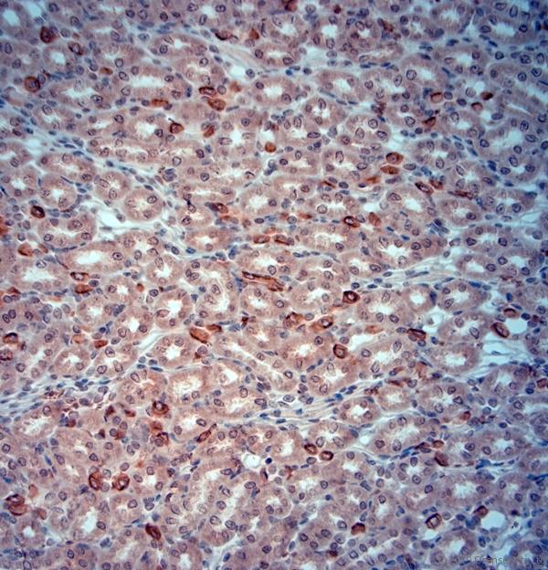 SLC4A1 / Band 3 / AE1 Antibody - IHC-P on paraffin sections of mouse kidney. The animal was perfused using Autoperfuser at a pressure of 130 mmHg with 300 ml 4% FA before being processed for paraffin embedding. HIER: Tris-EDTA, pH 9 for 20 min using Thermo PT Module. Blocking: 0.2% LFDM in TBST filtered through 0.2 µm. Detection was done using Novolink HRP polymer from Leica following manufacturers instructions; DAB chromogen: Candela DAB chromogen. Primary antibody: dilution 1:1000, incubated 30 min at RT using Autostainer. Sections were counterstained with Harris Hematoxylin. Small neurons are stained and also some nuclear staining is observed.