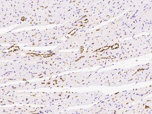 SLC4A1 / Band 3 / AE1 Antibody - Immunochemical staining of rat SLC4A1 in rat heart with rabbit polyclonal antibody at 1:500 dilution, formalin-fixed paraffin embedded sections.
