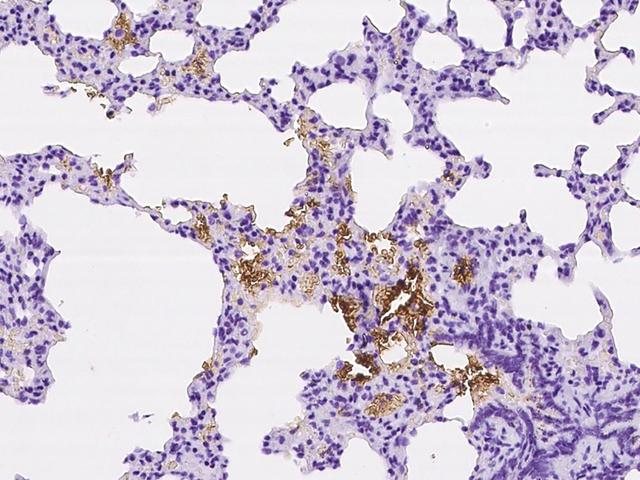 SLC4A1 / Band 3 / AE1 Antibody - Immunochemical staining of rat SLC4A1 in rat lung with rabbit polyclonal antibody at 1:1000 dilution, formalin-fixed paraffin embedded sections.